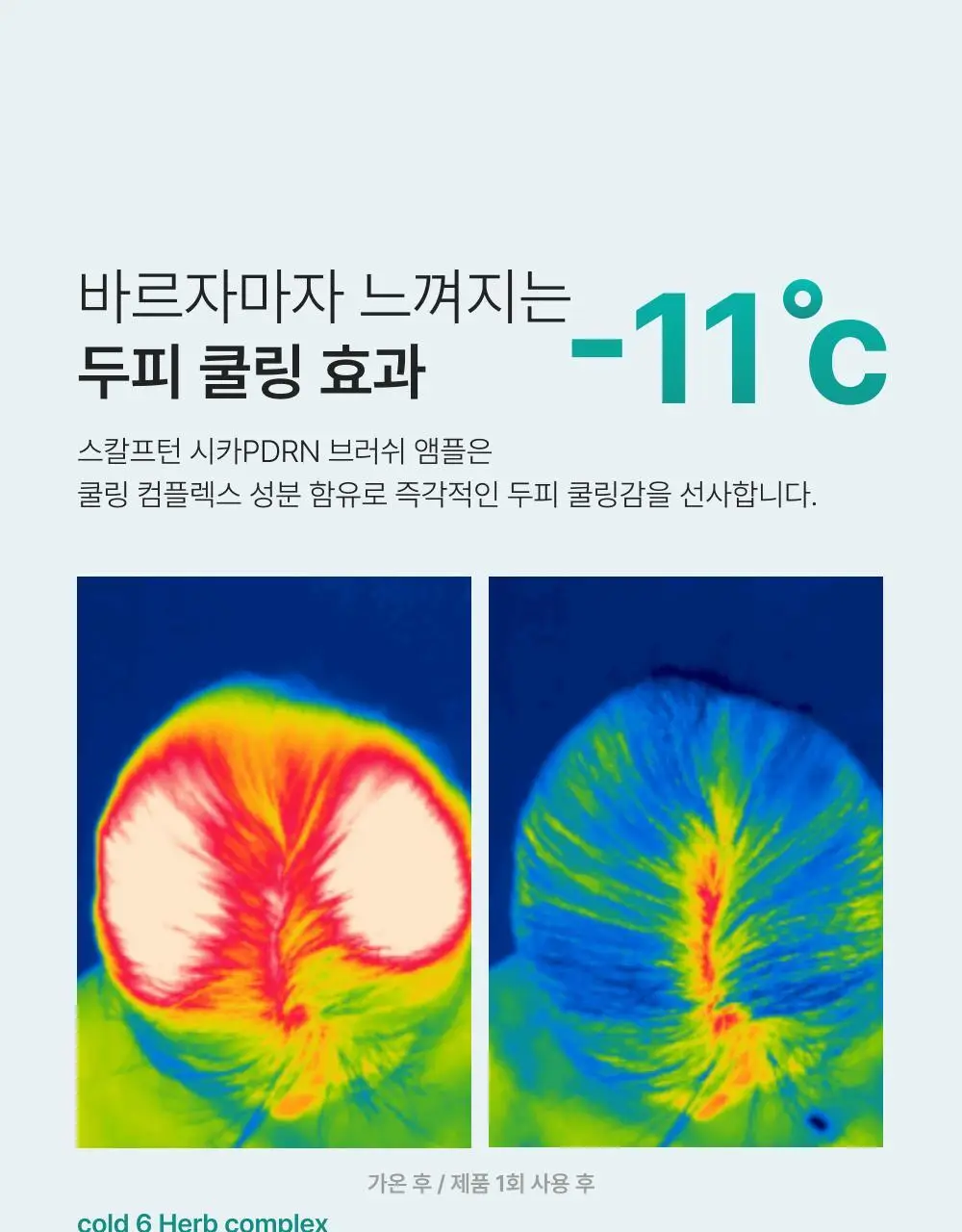 [포켓몬 에디션][비듬/각질케어]릴리이브 스칼프턴 시카 PDRN 브러쉬 앰플 100ml 2종 택1 상세페이지 32